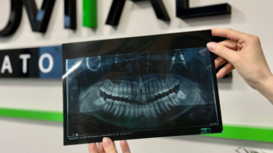 Pantomogram – kluczowe badanie diagnostyczne